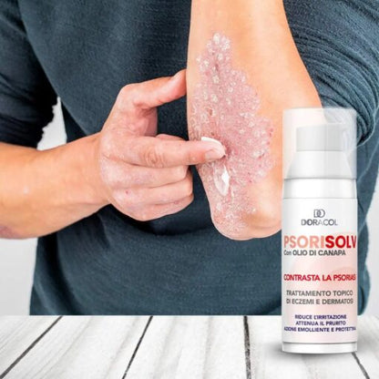 Sorisolv - Psoriasis Cream | Crema per psoriasi che riduce il prurito