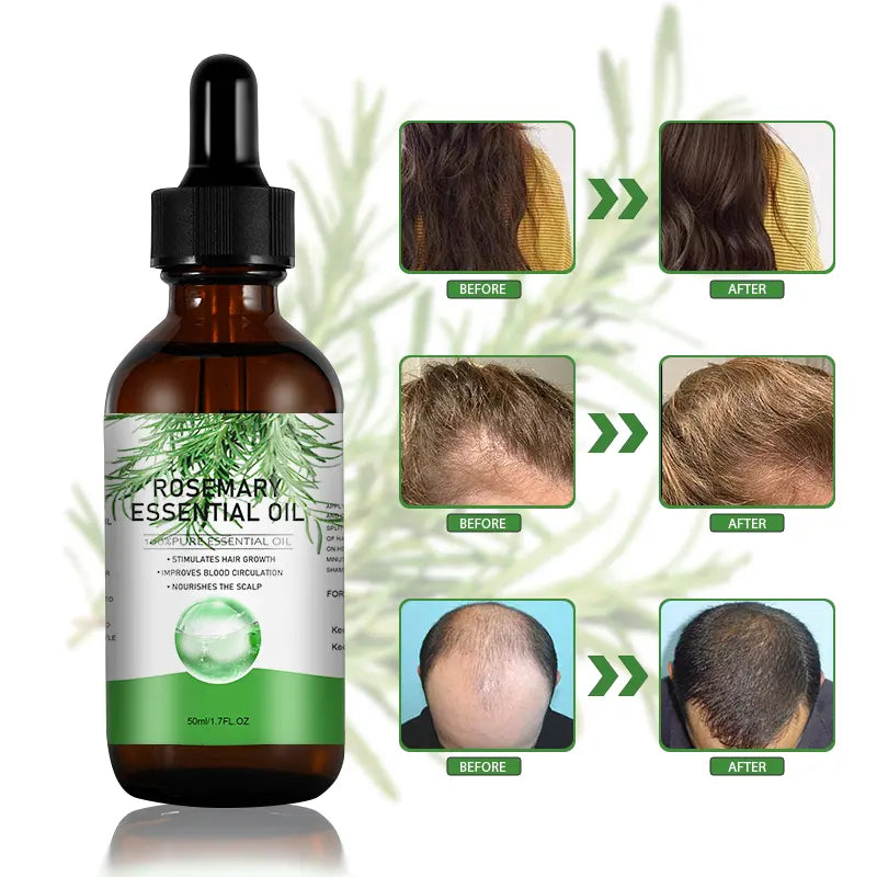 ROSEMARY OIL | olio per la crescita dei capelli per uomini e donne