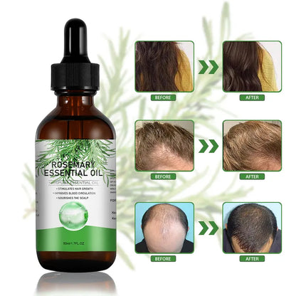 ROSEMARY OIL | olio per la crescita dei capelli per uomini e donne