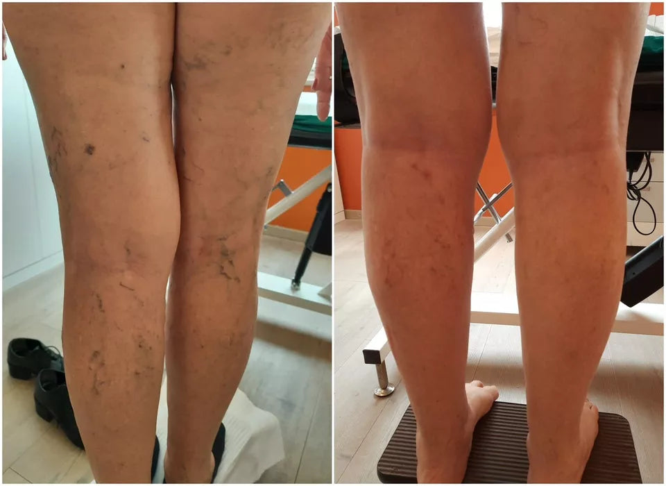 VeinFlux | Gel defaticante da 250ml